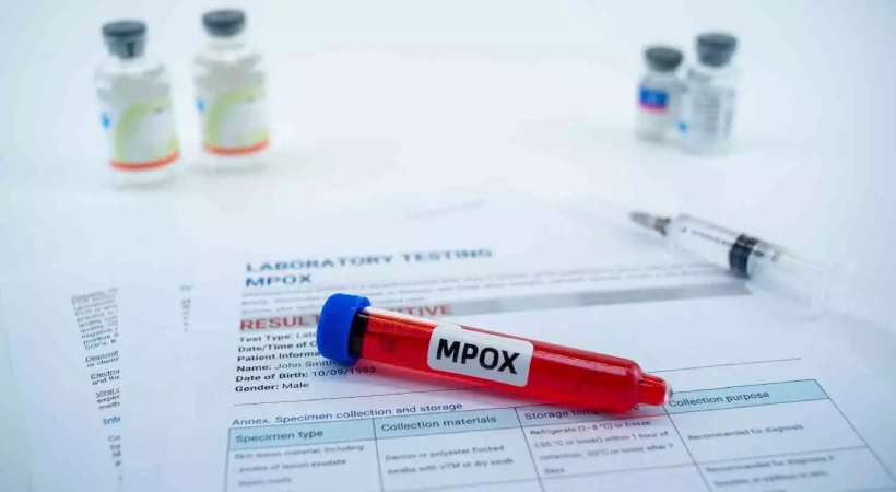 Mpox-confirmed-India-Centre-issues-safety-advisory-to-states.jpg